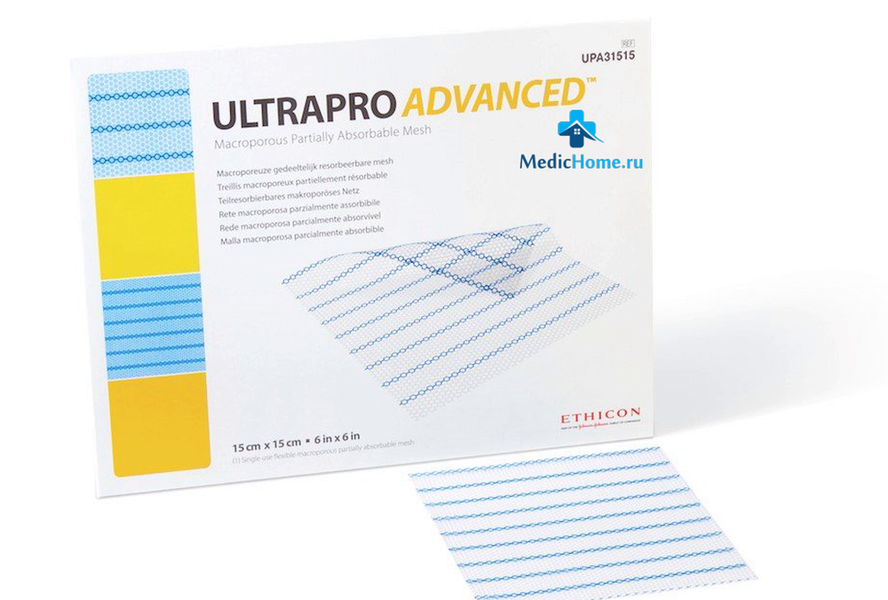 Сетка хирургическая Ethicon Ultrapro Advanced UPA31515